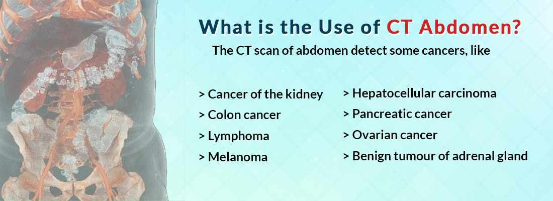 Use of CT Abdomen